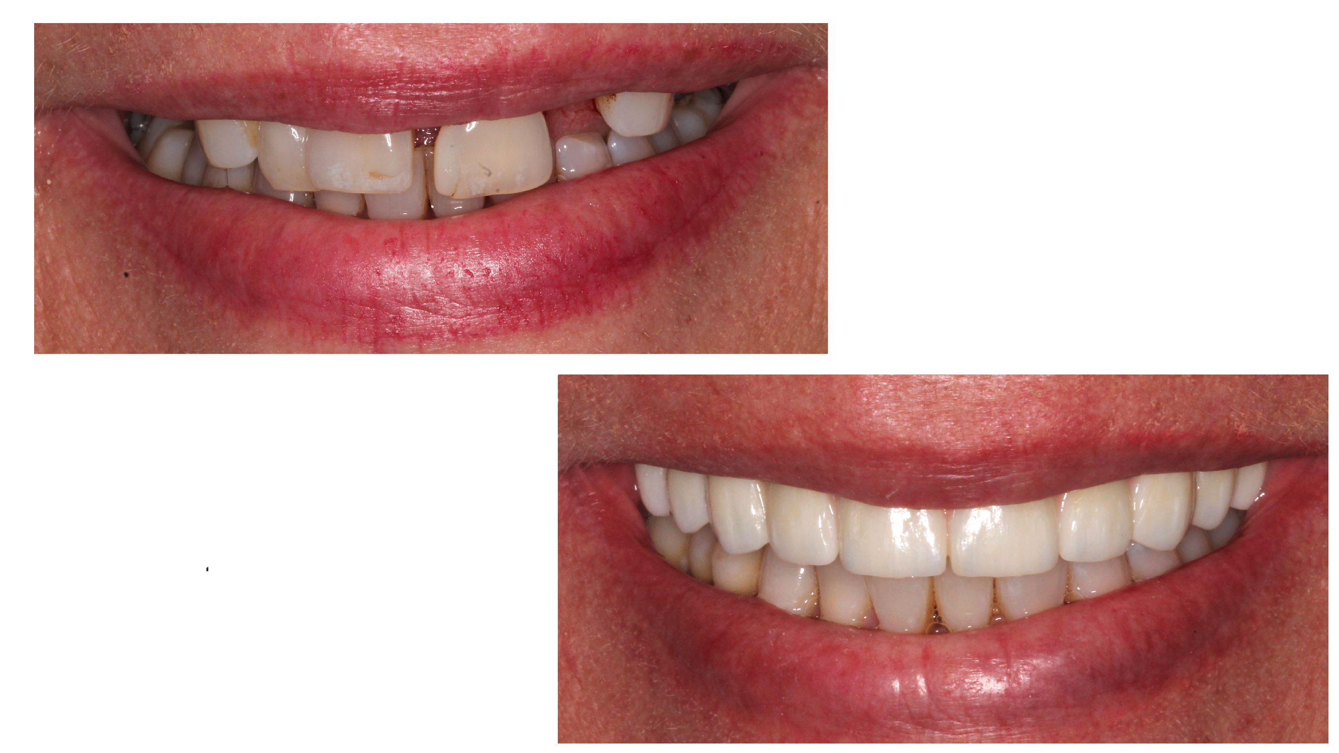 Stamford Dental Group, LLC | Dental Implants, Crowns & Bridges/Prosthodontics and Cosmetic Dentistry/Restorative Dentistry