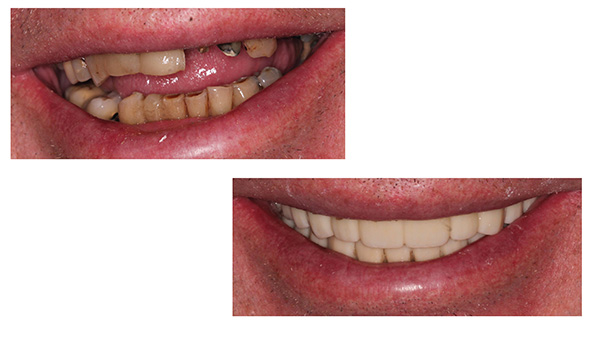 Stamford Dental Group, LLC | Cosmetic Dentistry Restorative Dentistry, Early Detection and Prevention and Intra-Oral Scanner