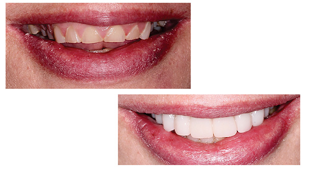 Stamford Dental Group, LLC | Cosmetic Dentistry Restorative Dentistry, Cone Beam CT Technology and Trios reg  3D Scanner and Smile In One Day