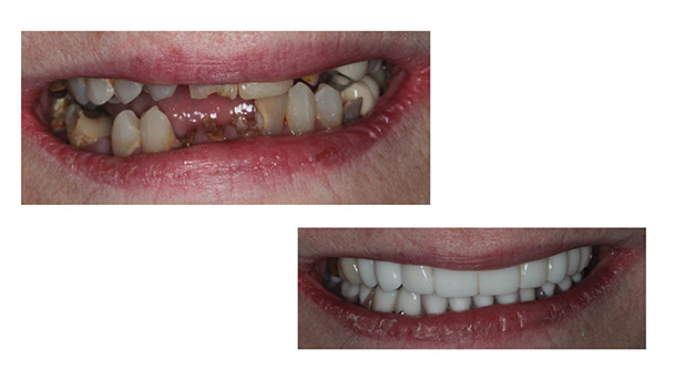 Stamford Dental Group, LLC | Cone Beam CT Technology and Trios reg  3D Scanner, Cosmetic Dentistry Restorative Dentistry and Laser Dentistry Periodontal Care