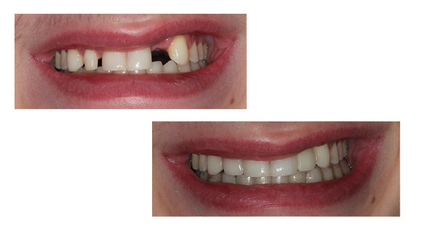 Stamford Dental Group, LLC | Cosmetic Dentistry Restorative Dentistry, Smile In One Day and Cone Beam CT Technology and Trios reg  3D Scanner